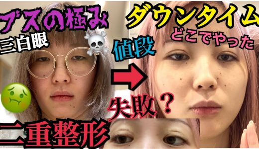 【初整形】ブスが二重整形して来ました‼︎‼︎ダウンタイムを初公開します。
